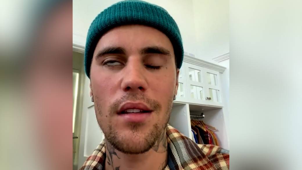 Click to play video: 'Justin Bieber reveals he has facial paralysis as a result of Ramsay Hunt syndrome'