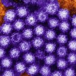 Norovirus in Kerala: What is norovirus?  Causes, symptoms, transmission prevention