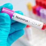 What is Norovirus infection - check out causes, symptoms and prevention